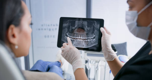 Licensed Tooth Extraction service in Galveston, TX - Smile Center Dentistry